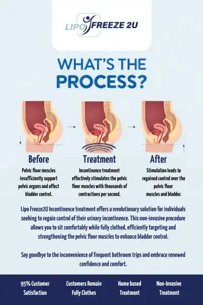 Diagram of how incontinence treatment Royal Tunbridge Wells works.