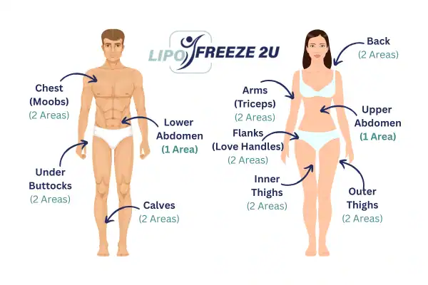 Areas you can have fat freezing treatment Royal Tunbridge Wells