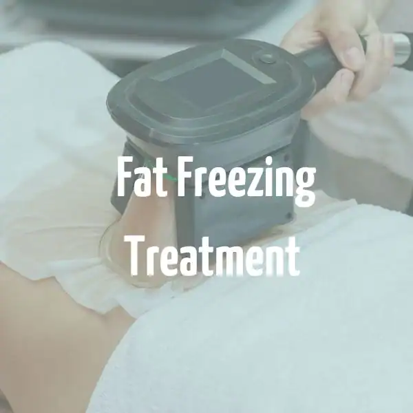 fat freezing treatment Royal Tunbridge Wells