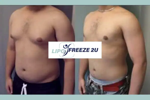 How Long Does It Take to See Results Royal Tunbridge Wells?