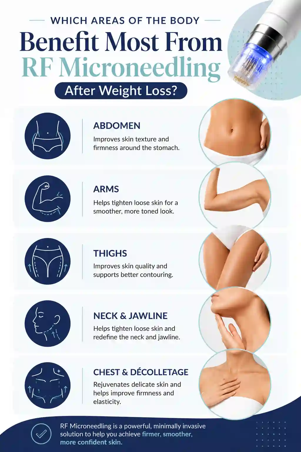 Which Areas of the Body Benefit Most From RF Microneedling After Weight Loss Royal Tunbridge Wells